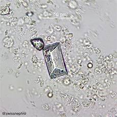 Triple Phosphate